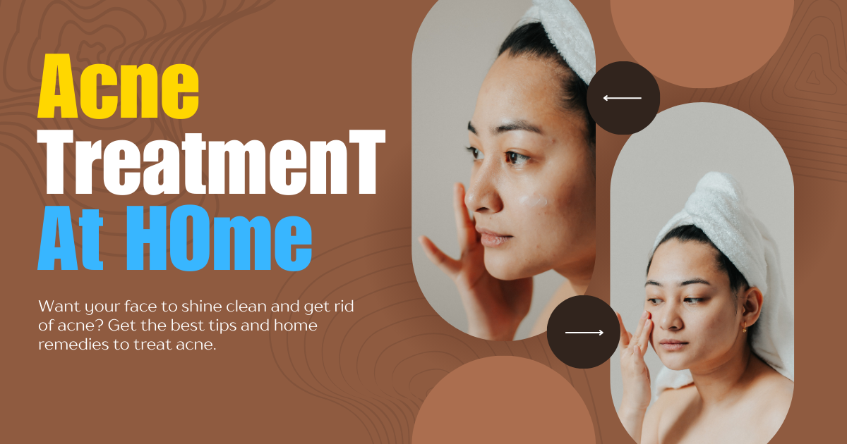 Acne Treatment At Home