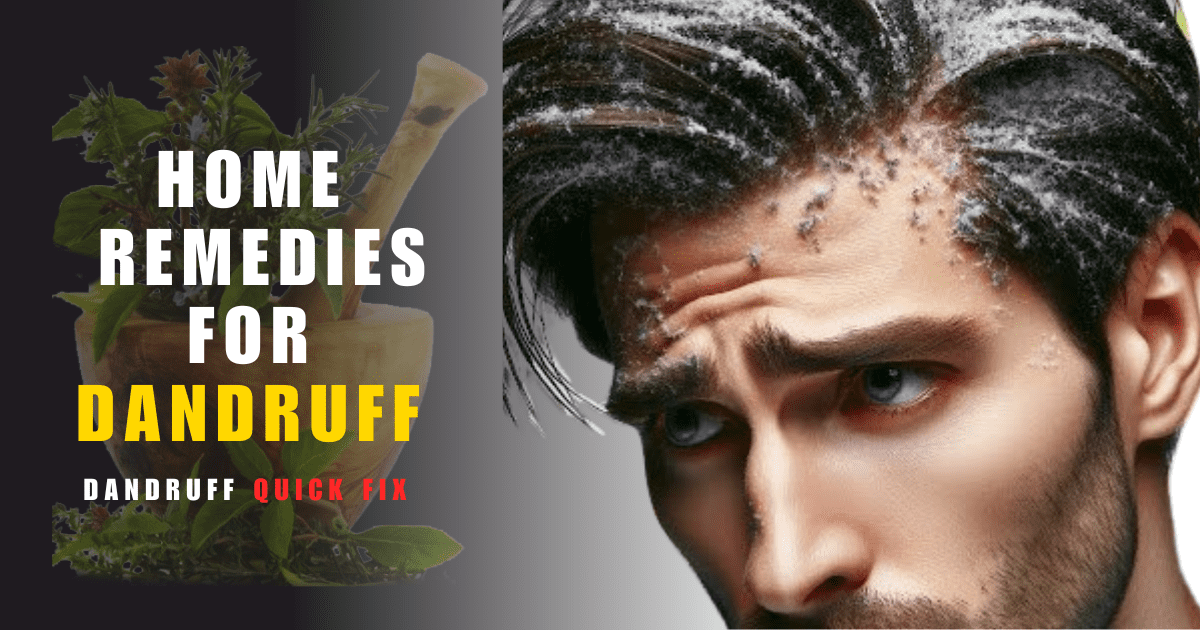 Home Remedies for Dandruff featured Image