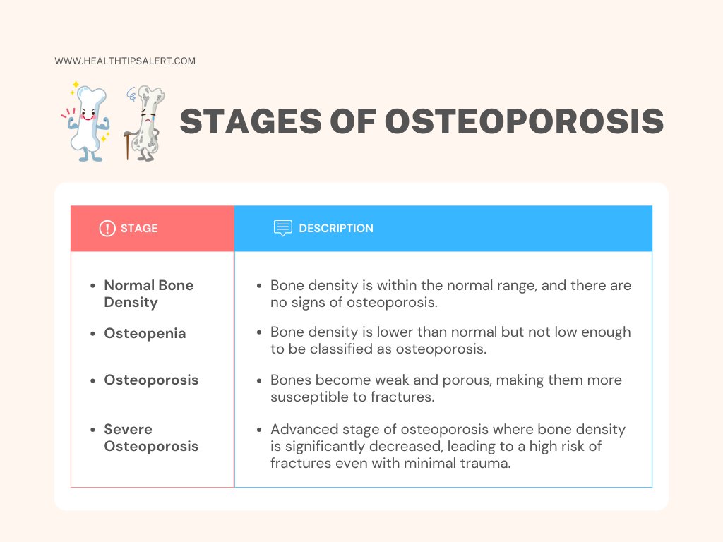 Stages of Osteoporosis