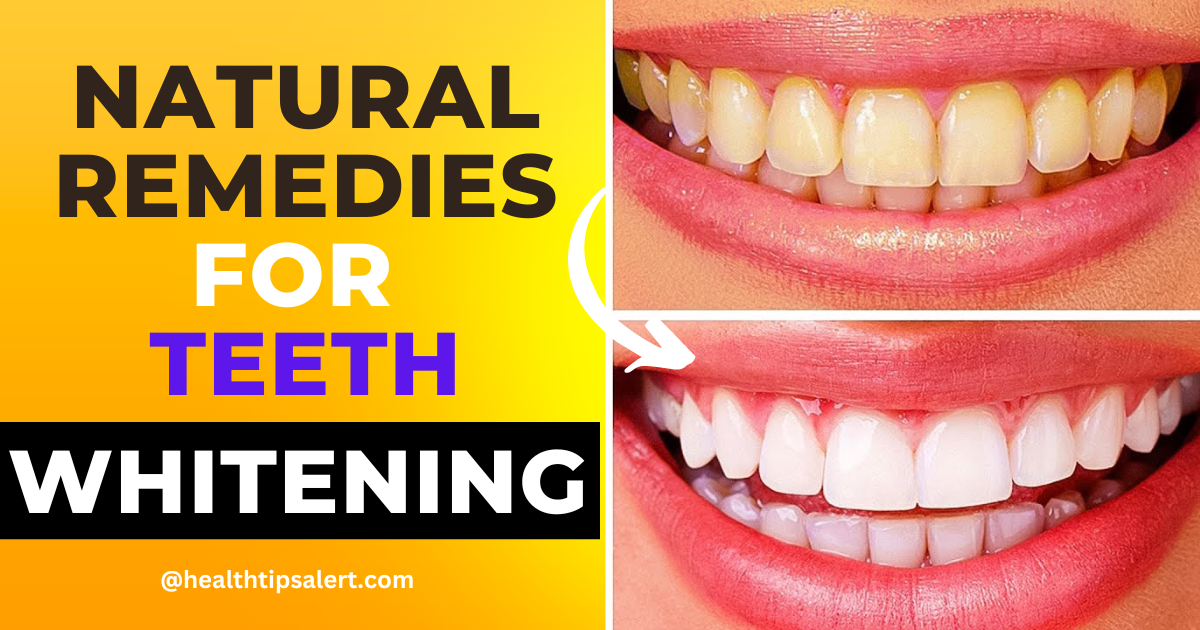 Natural Remedies For Teeth Whitening