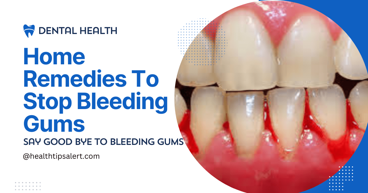 Home Remedies To Stop Bleeding Gums